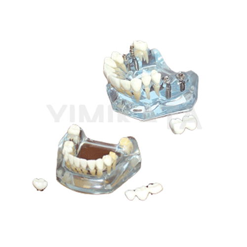 Modelo de enseñanza, Consumibles dentales, material dental, clinica dental, dent